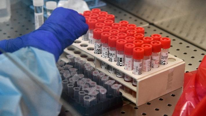 Tornano le restrizioni nella regione di Lisbona. Florida: superati i 100 mila casi