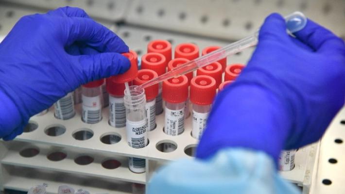  Israele, un farmaco prodotto dagli  anticorpi sembra avere successo