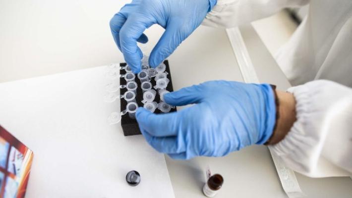 Italia, calano i contagi (e anche i tamponi). I nuovi positivi sono 953