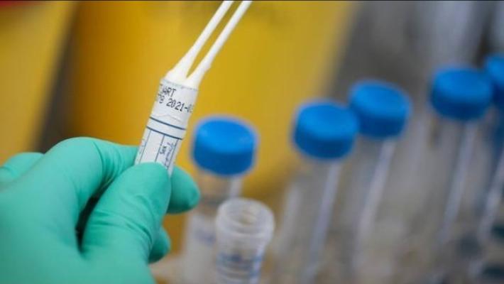 Italia, lievissimo calo nei contagi (1.444 contro i 1.462 di ieri). Un morto