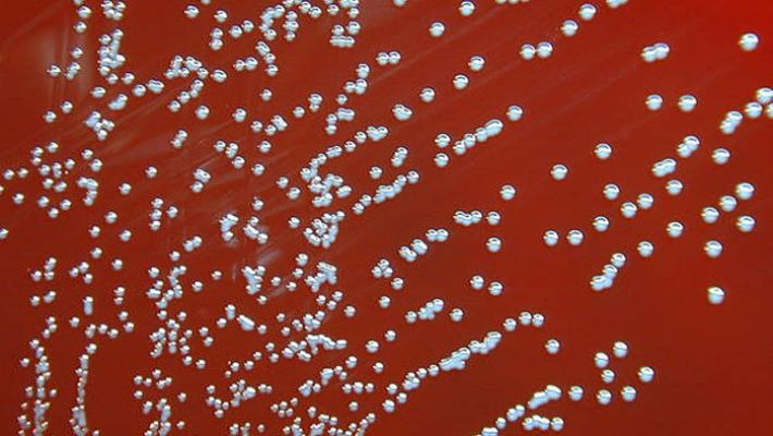 Cina: 3mila infettati da batterio fuggito da un laboratorio