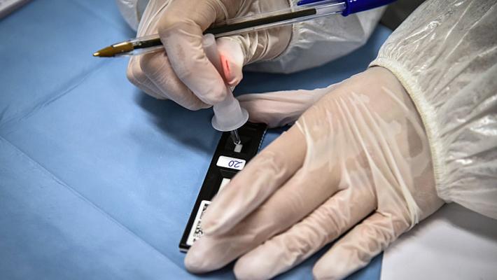 Covid: rilevare immunità in 10 minuti, ora si può