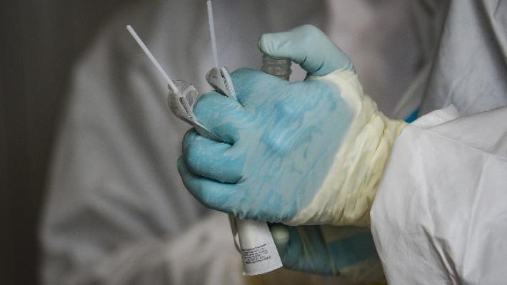 76 nuovi contagi a Parma: due decessi (sono due uomini di 95 e 85 anni). Restano 8 i pazienti in terapia intensiva