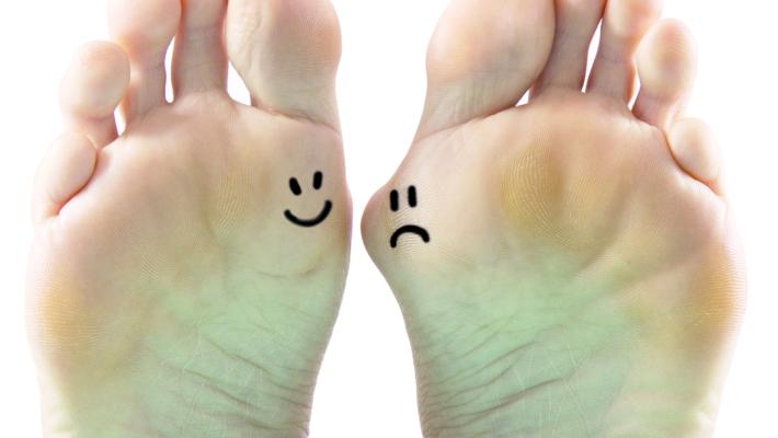 Alluce valgo,  quando servono  scarpe  comode. E quando il bisturi