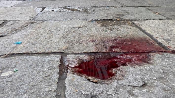 Sabato di paura: rissa con catene in Pilotta, minore ferito in via Verdi e raid di baby gang in Galleria