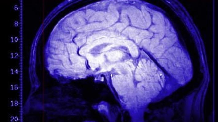 Giornata nazionale Parkinson: tre giorni di iniziative in città e provincia organizzate dalle Aziende sanitarie