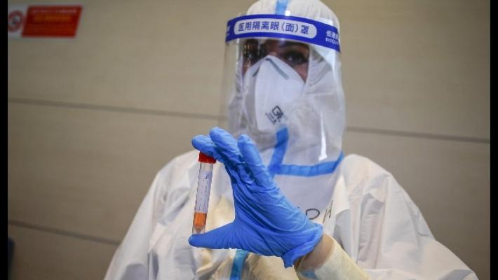 Nelle ultime 24 ore altri 4 morti nel Parmense e 75 casi. Stabili i ricoveri in terapia intensiva (13)