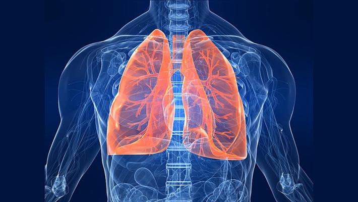 Asma, sì alla messa in commercio della prima tripla terapia in un unico inalatore. E' "firmata" Chiesi