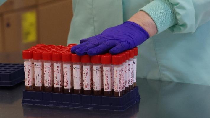 Con 27 nuovi casi Parma &egrave; seconda in Emilia Romagna per contagi, ma nessun decesso. Stabile il numero dei pazienti in terapia intensiva (5)