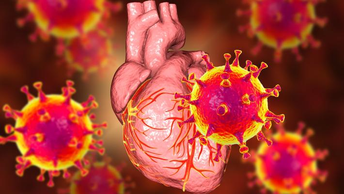 Covid-19 e miocardite nei giovani atleti