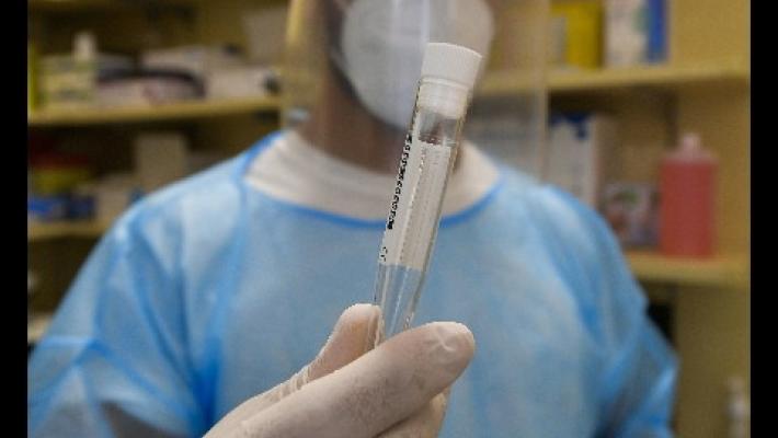 Covid: 5.923 nuovi contagi, 69 vittime. Tasso positività 2%