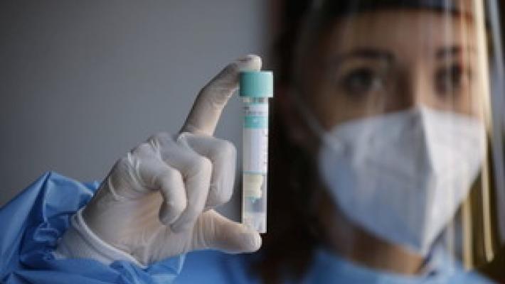 Covid, 1.612 nuovi casi e 37 decessi nelle ultime 24 ore in Italia