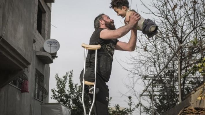 Bimbo e papà senza arti, la foto simbolo del dramma siriano 