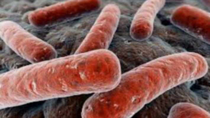 Reggio Emilia, un caso di tubercolosi al liceo Matilde di Canossa