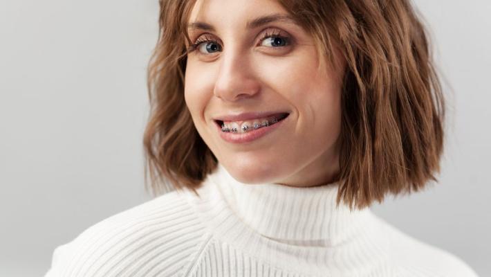Italiani e sorriso, sempre più adulti con l'apparecchio ortodontico