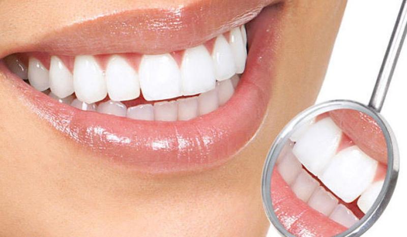 Salute orale Oggi i dentisti   in piazza